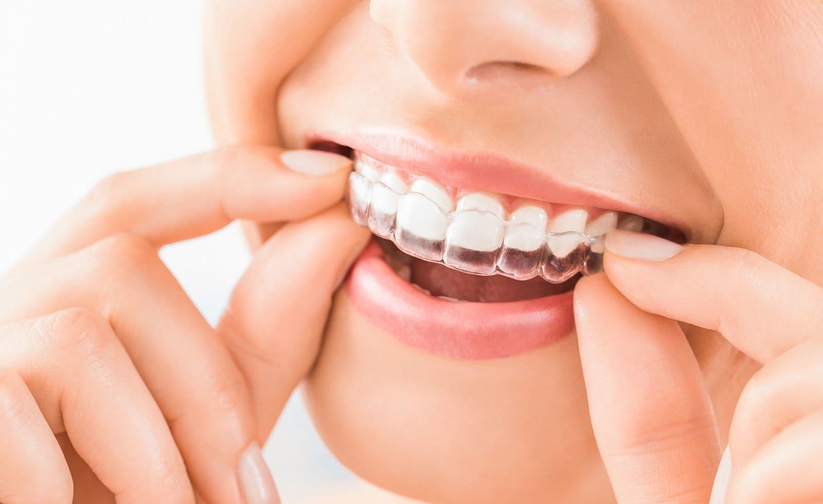 Guest photo from a Google review at Polaris Dental
