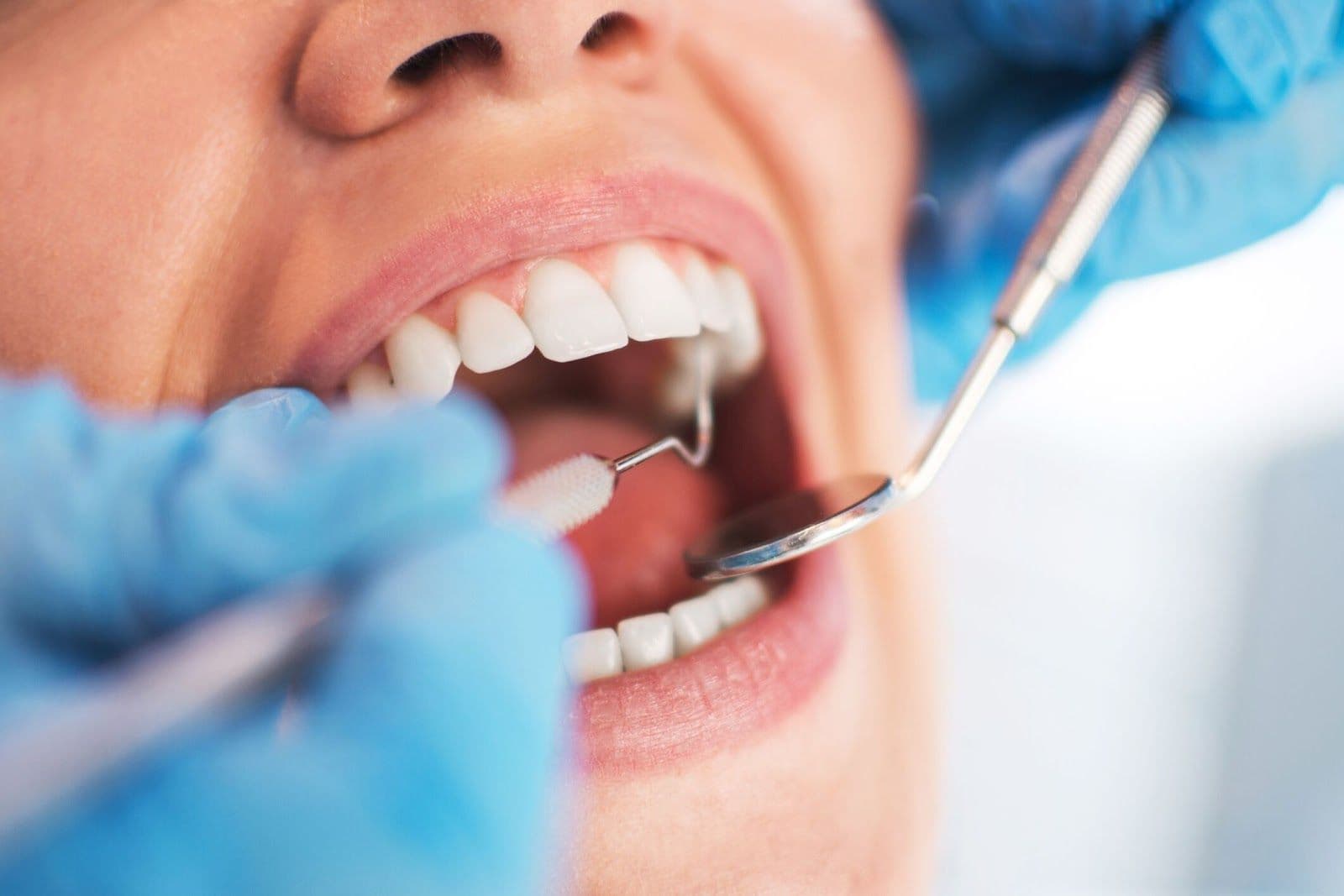 Another guest photo from a Google review at Markham Smile Centre