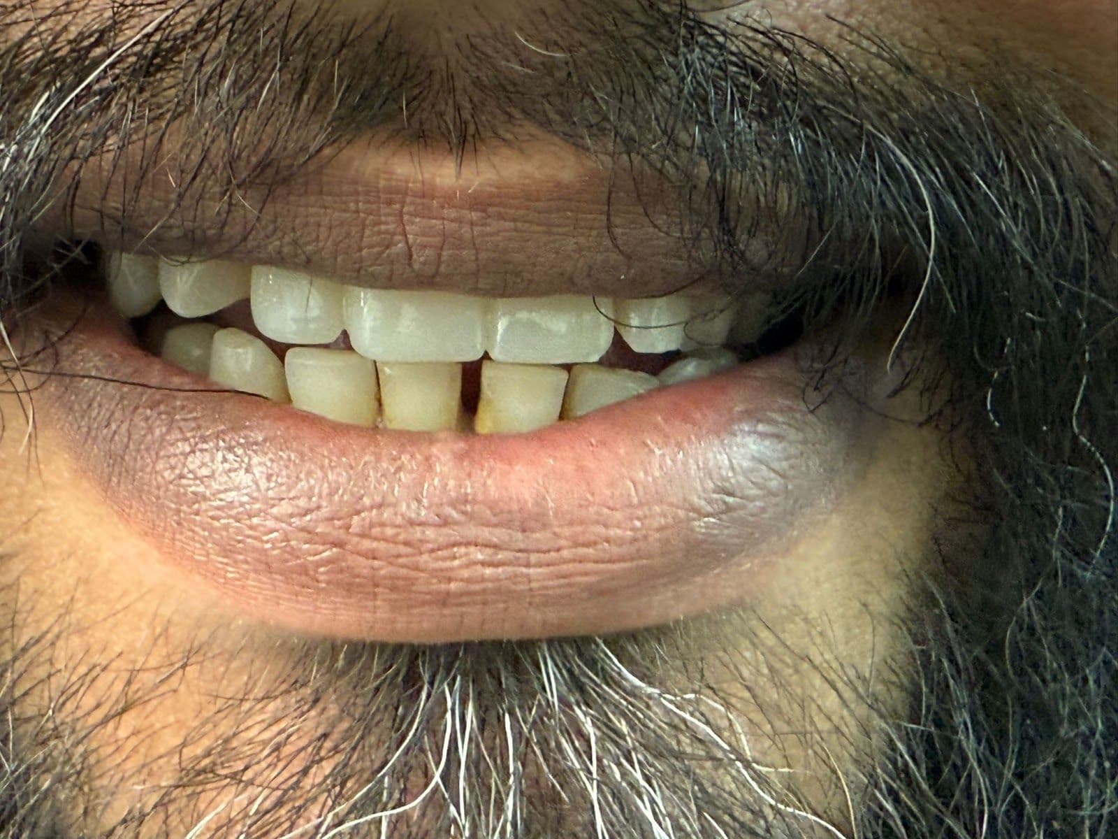 Another guest photo from a Google review at Brampton Dental Care