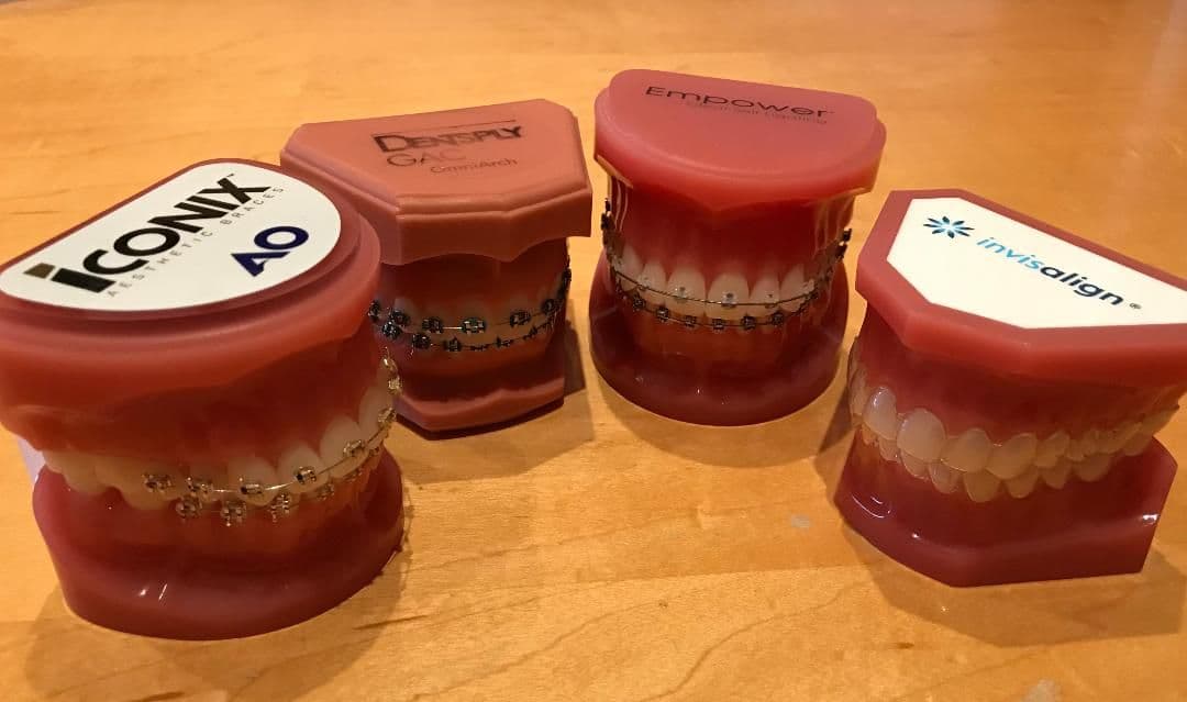 Another guest photo from a Google review at Braces in Markham