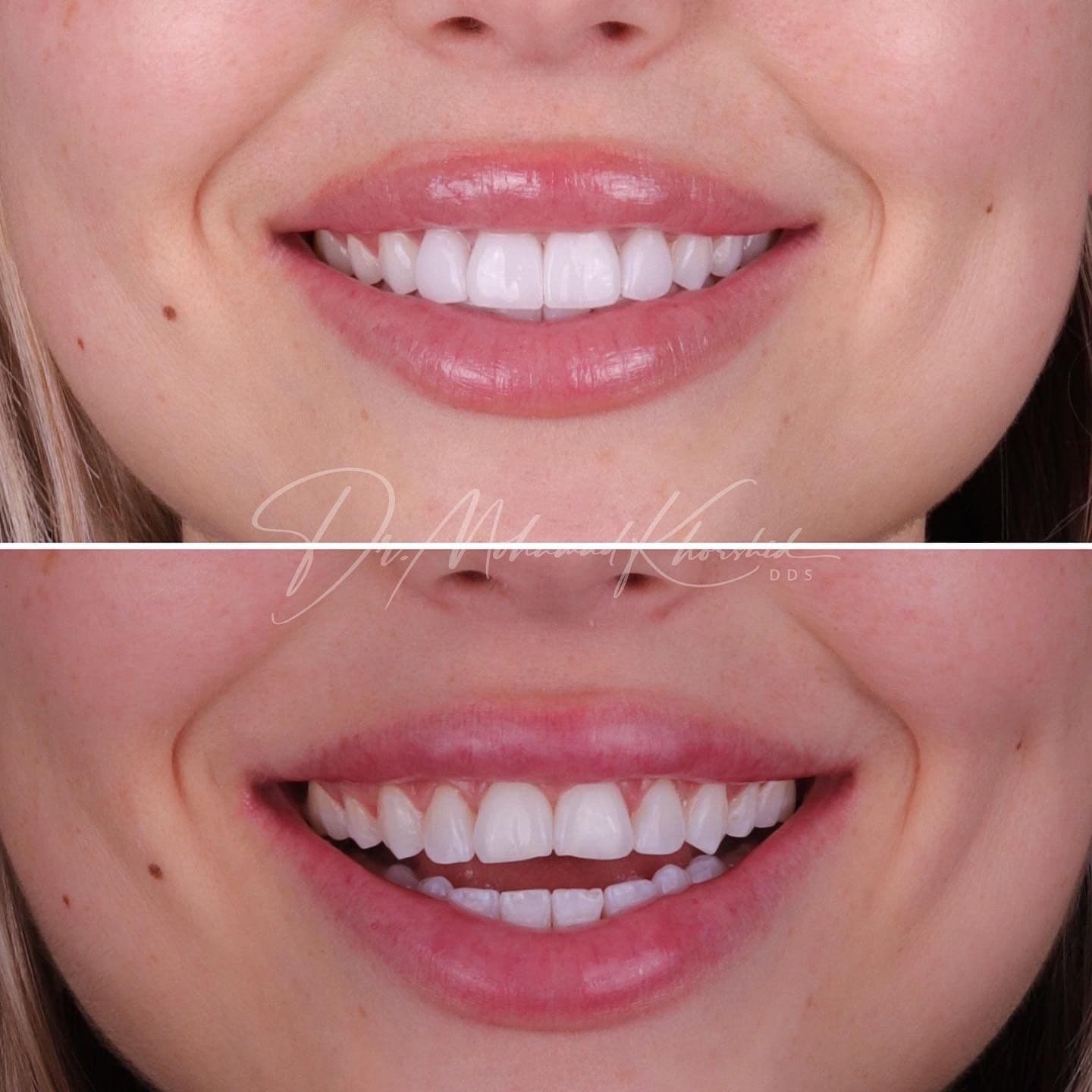Another guest photo from a Google review at Mississauga Smiles Dentistry