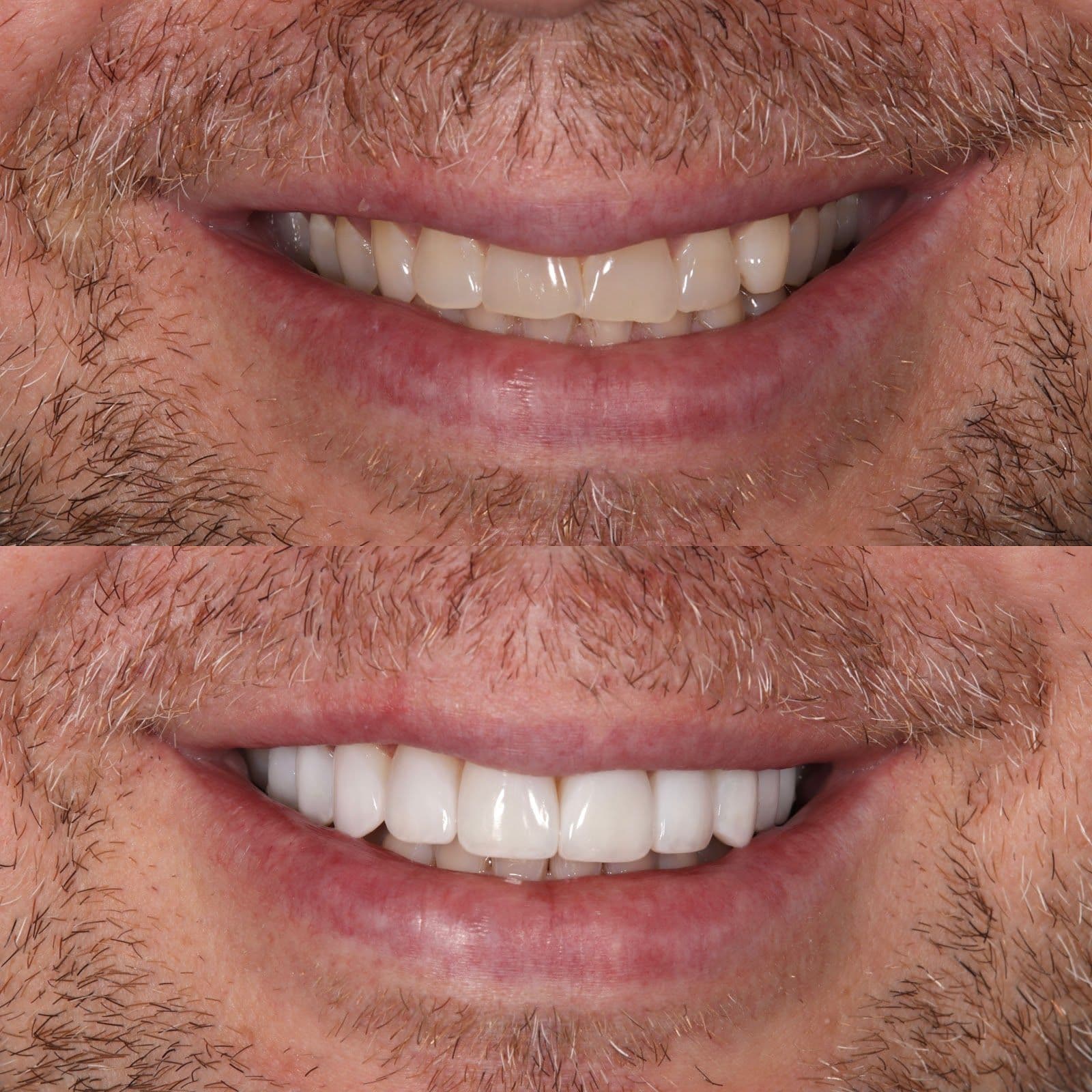 Another guest photo from a Google review at Inspire Dental Studio