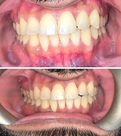 Another guest photo from a Google review at Align Dental Smiles - Brampton
