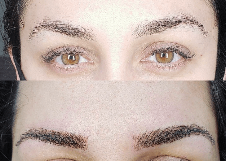 Guest photo from a Google review at Crystal Derm