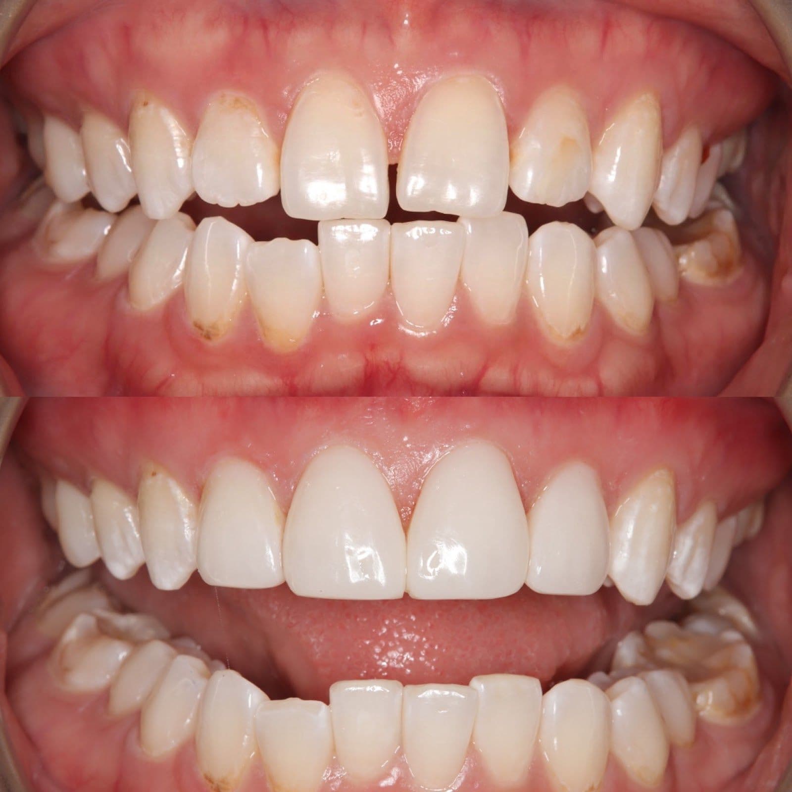 Guest photo from a Google review at Inspire Dental Studio