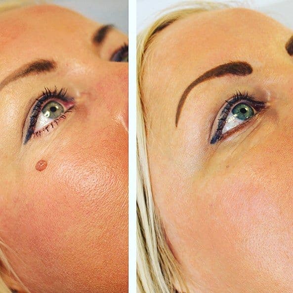 Guest photo from a Google review at DermCare Clinic