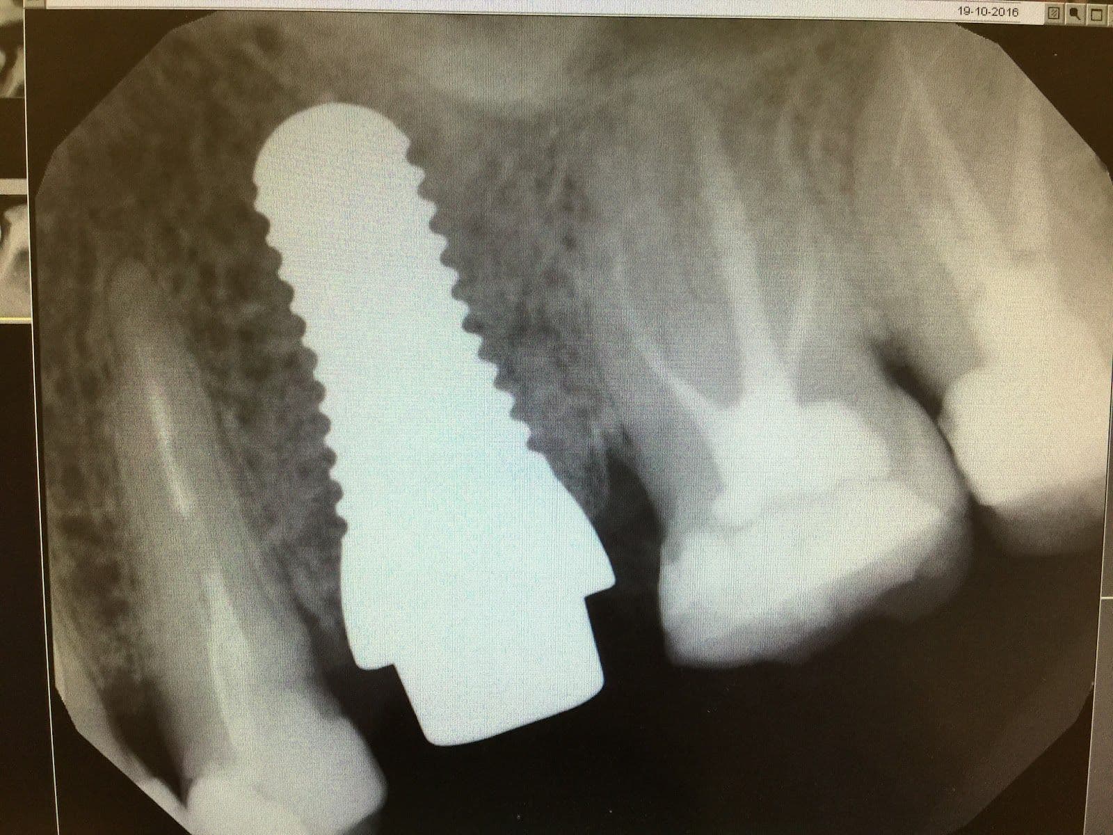 Another guest photo from a Google review at Marketplace Dentistry