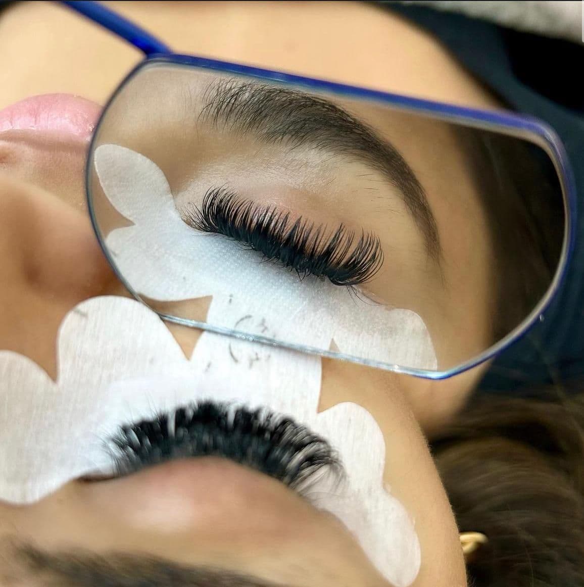 Another guest photo from a Google review at LaserLuxe Skin Clinic