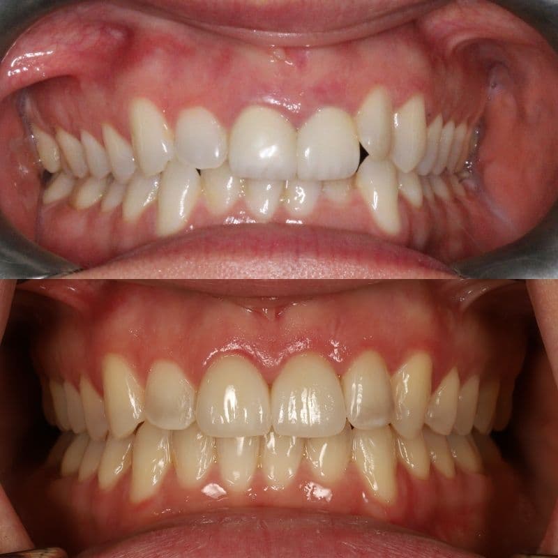 Another guest photo from a Google review at 905 Dental Brampton