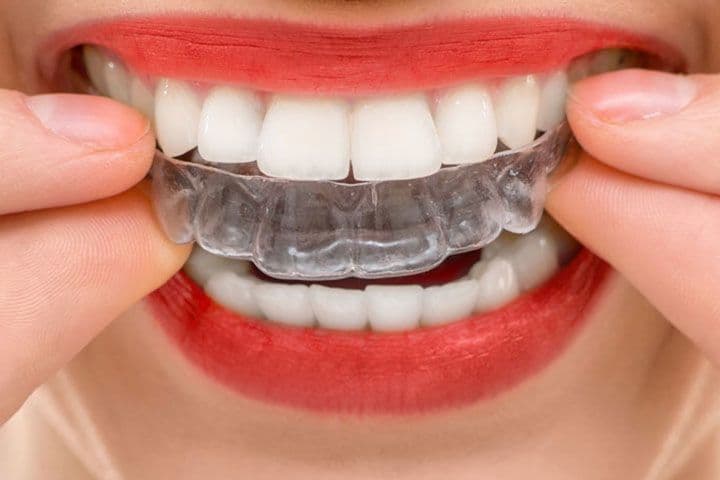 Another guest photo from a Google review at GD Orthodontics