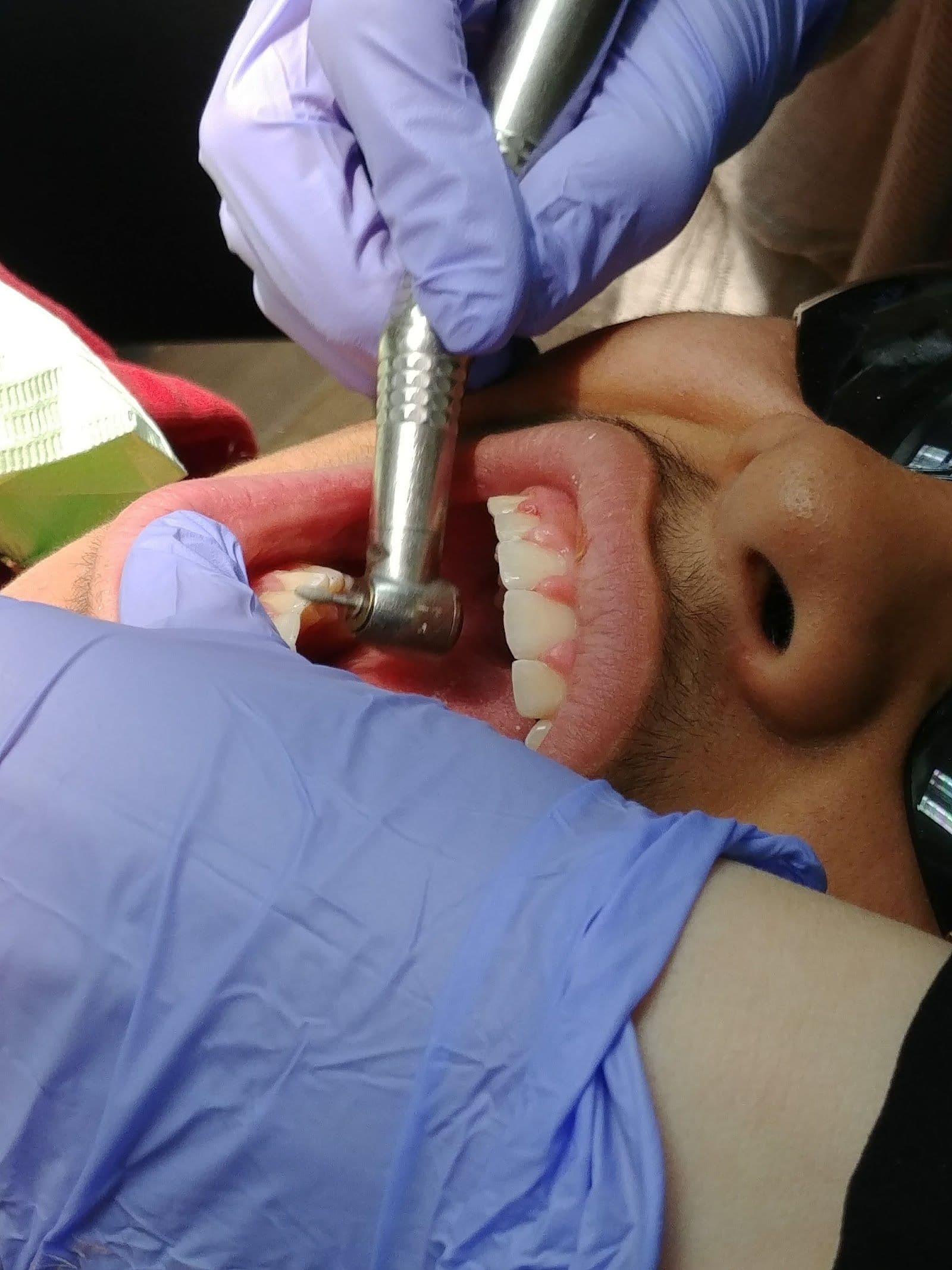 Another guest photo from a Google review at Village Orthodontics