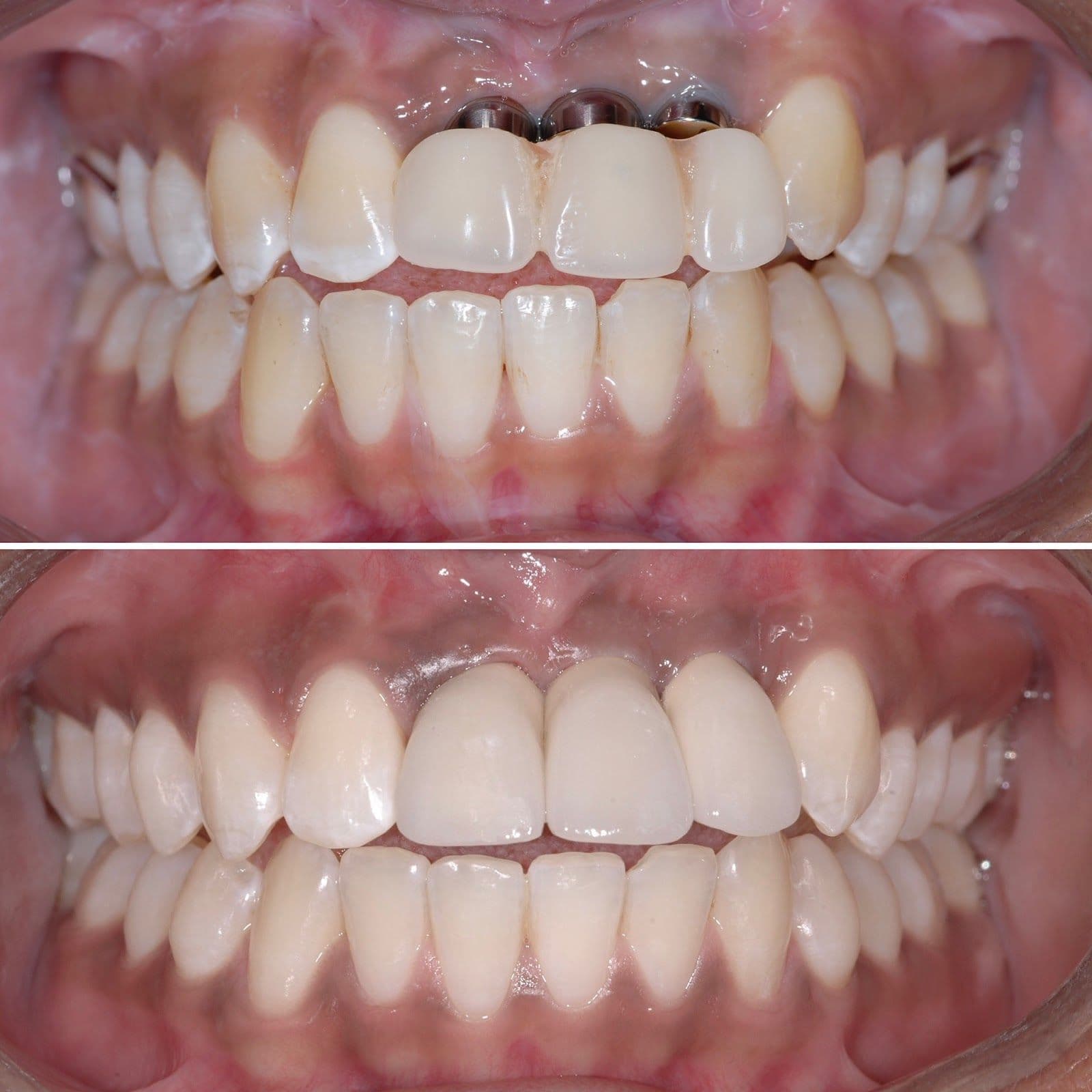 Another guest photo from a Google review at Dr Arun Narang & Associates Smile by Design
